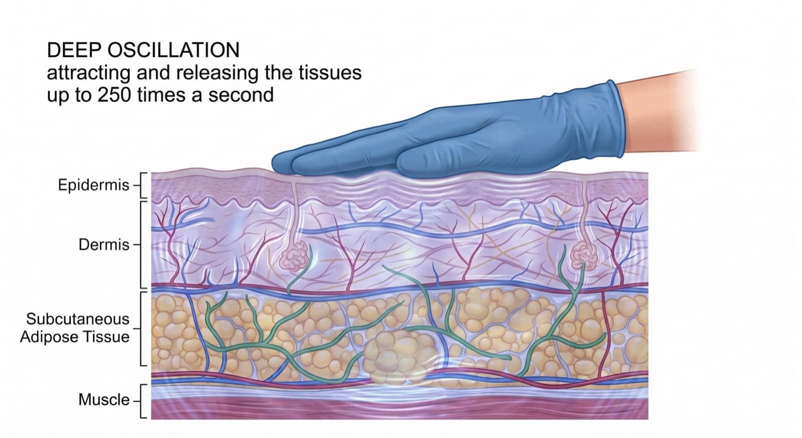 An illustration of a gloved hand resting on a cross-section of skin, demonstrating how Deep Oscillation therapy creates a visible rippling effect that attracts and releases deep tissue layers up to 250 times a second.